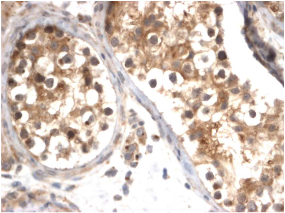 Figure 1. Immunohistochemical staining human testis tissue using SALL4 antibody (Cat. No. X2797P). Antibody used at 2 μg/ml. 40x magnification. Pathologists comments: Diffuse cytoplasmic staining of the seminiferous tubules.